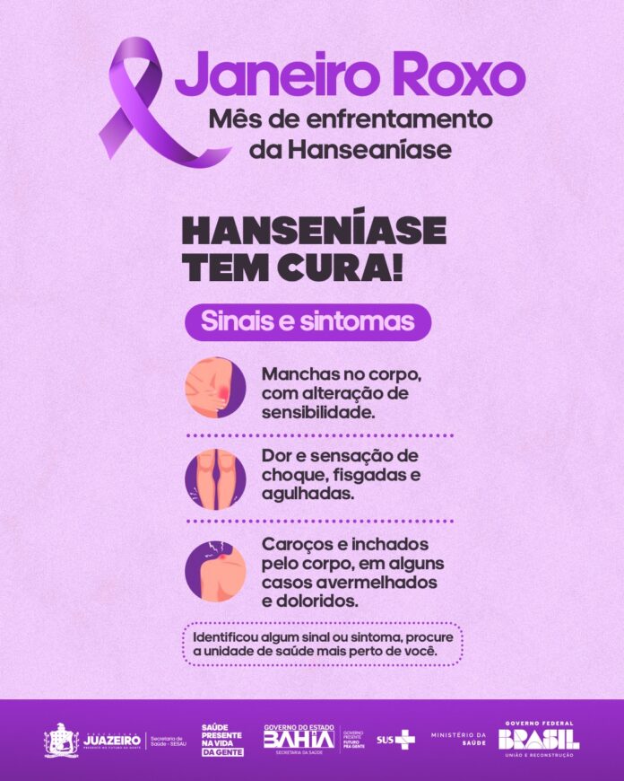 Sesau de Juazeiro reforça alerta sobre o Janeiro Roxo, mês de enfrentamento à hanseníase Sesau de Juazeiro reforça alerta sobre o Janeiro Roxo, mês de enfrentamento à hanseníase