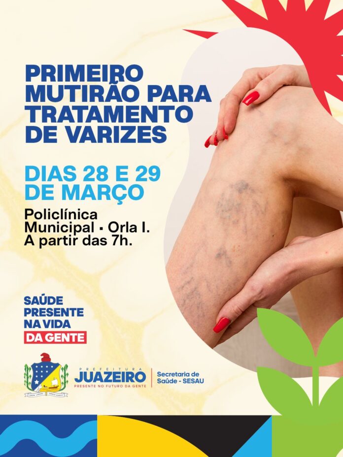 Prefeitura de Juazeiro realiza mutirão inédito para tratamento de varizes