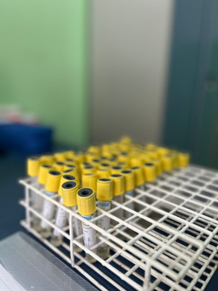 LACEN de Juazeiro terá atendimento temporariamente interrompido para conclusão de melhorias estruturais